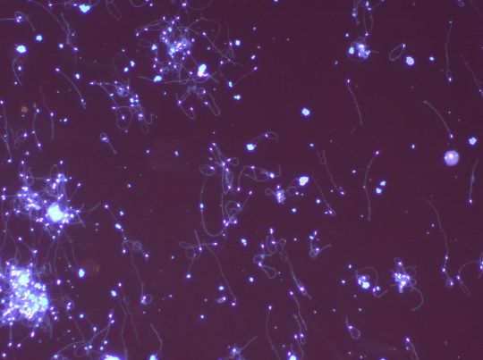 Brown MicroBEEome Spermatozoa.JPG