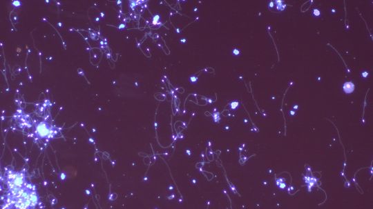 Brown MicroBEEome Spermatozoa.JPG