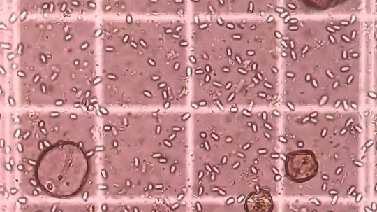 Nosema Spores_Al Naggar.jpg