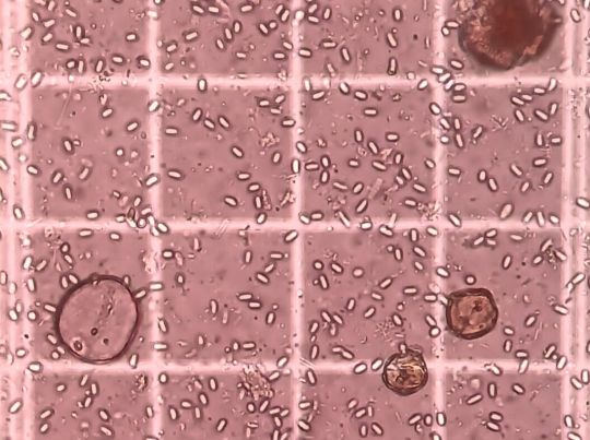 Nosema Spores_Al Naggar.jpg